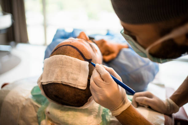 Hair Transplant Hair Transplant